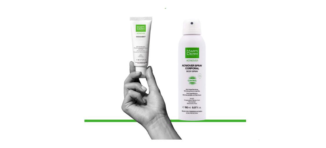 MartiDerm - ACNIOVER CICAVENT y SPRAY CORPORAL